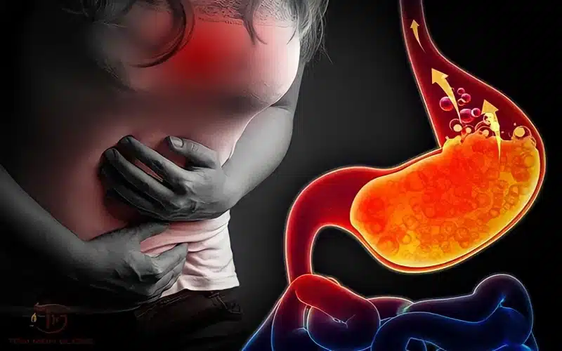 Ợ nóng khó thở: Dấu hiệu cảnh báo bệnh trào ngược dạ dày